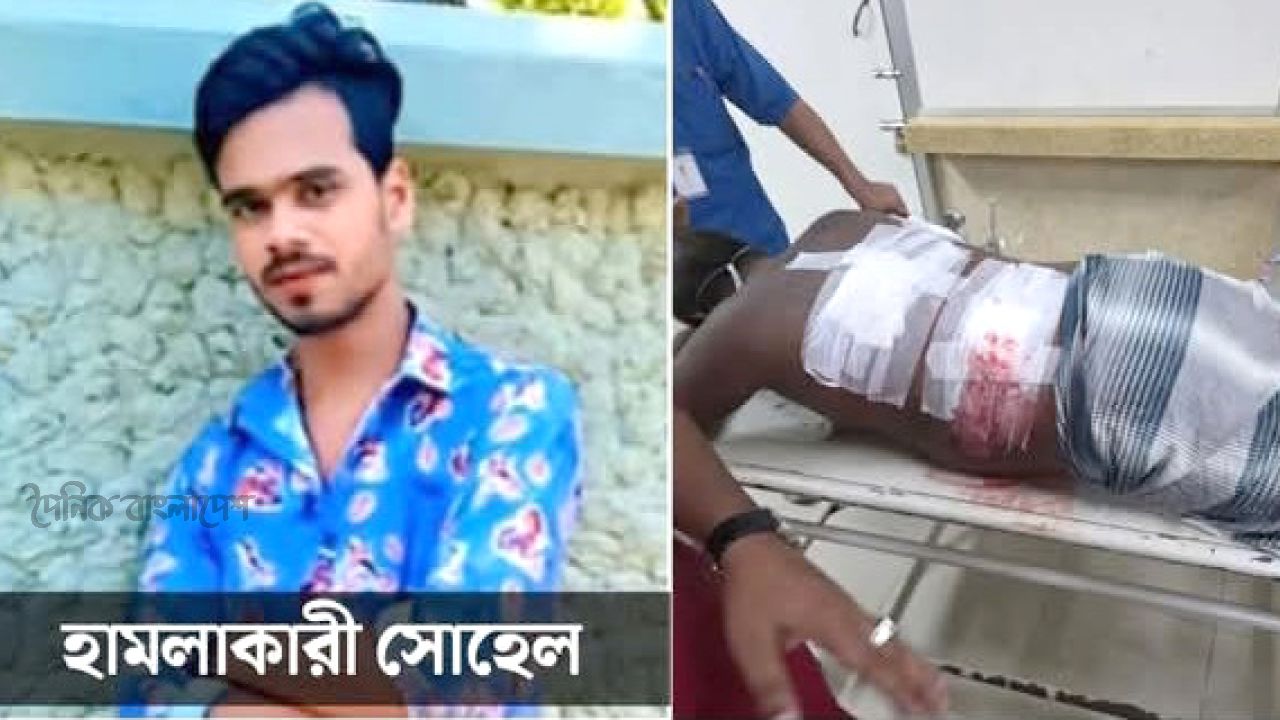 ঈদগাঁও বাসস্ট্যান্ডে কম্পিউটার দোকানের কর্মচারীকে ছুরিকাঘাত, আটক ১
