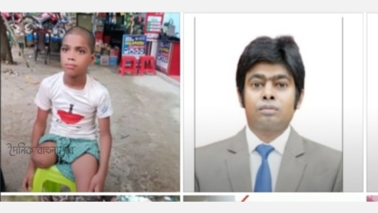 পা হারানো রায়হানের পাশে থাকার আশ্বাস ইউএনওর